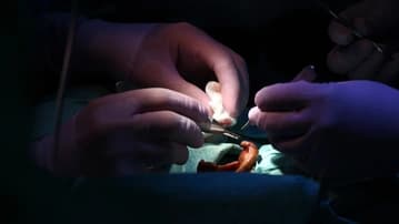 Ilustrační obrázek k Domnělá pozorovatelka OBSE, americký plukovník ve výslužbě a ruský voják šíří nepodložená tvrzení o obchodu s orgány dětí na Ukrajině